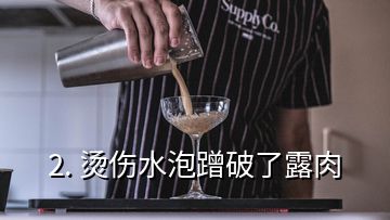 2. 烫伤水泡蹭破了露肉